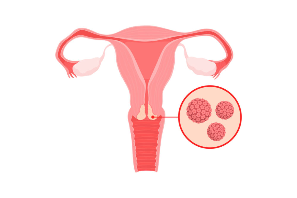 Cervix diagram